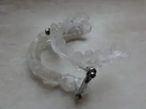 Discover if you're a candidate for oral appliance therapy